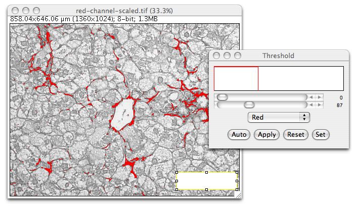 quantify threshold imagej within selected area