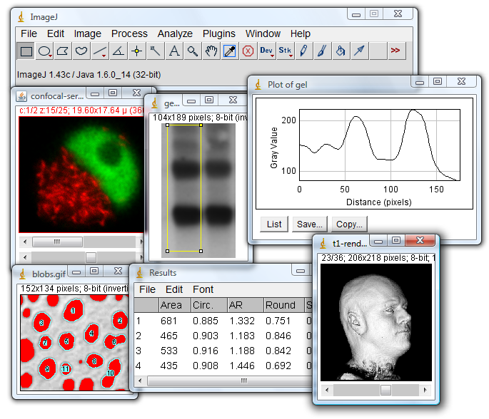 NIH software called ImageJ or Fiji