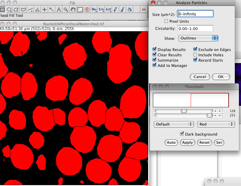 NulceiDAPIconfocalAnalyzeParticles.png