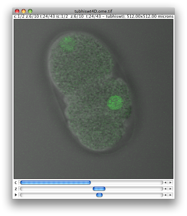 C. elegans embryo coexpressing tubulin histone GFP