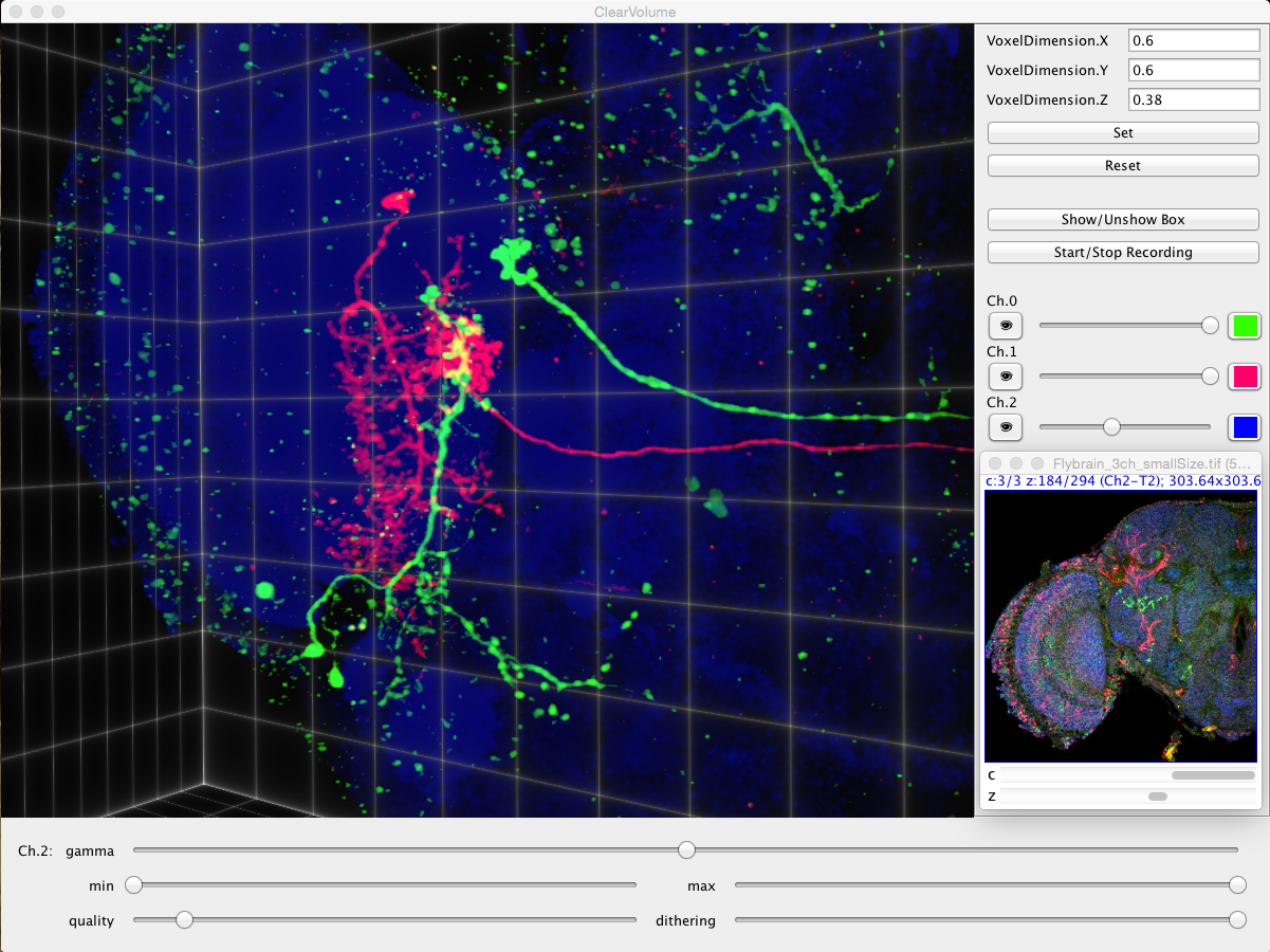 imagej fiji pseudopod