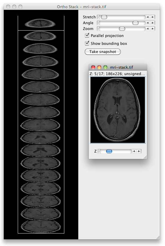 /media/news/visbio-ortho-stack.png