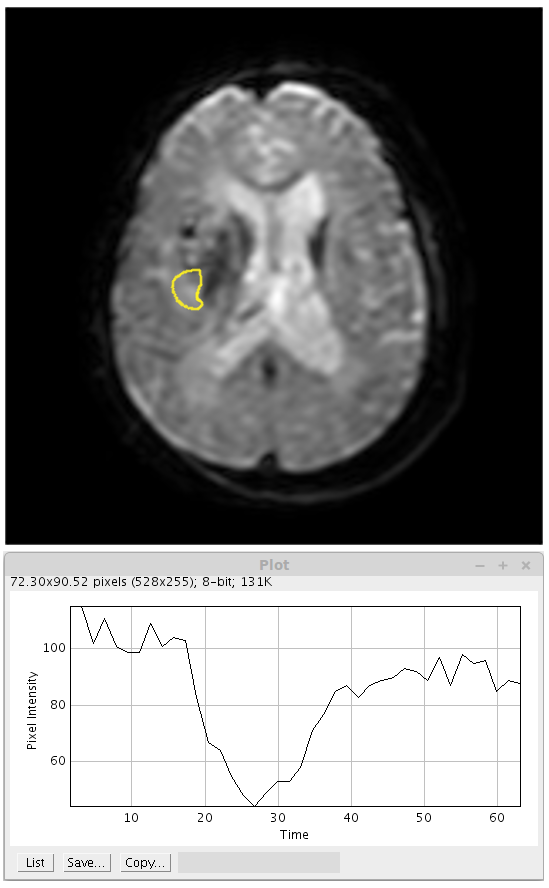 perfusion