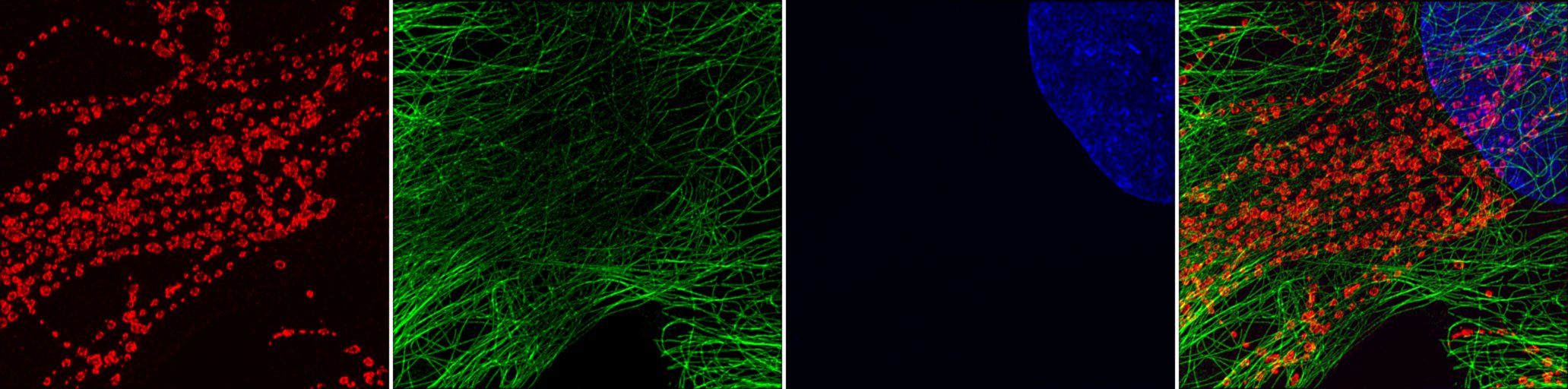 3 channels image, in Red Green Blue and Merge