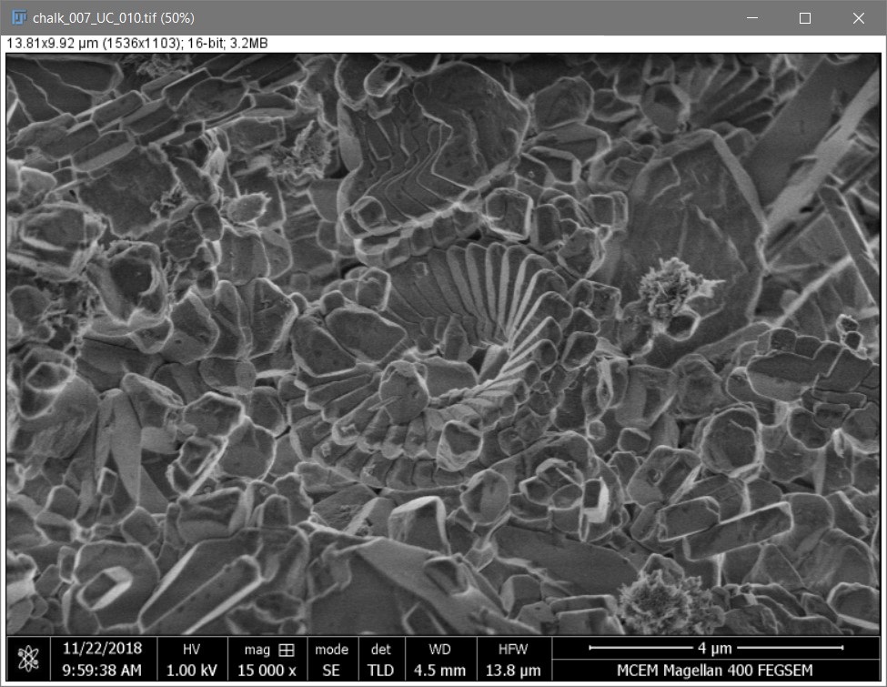 Imagej Set Scale