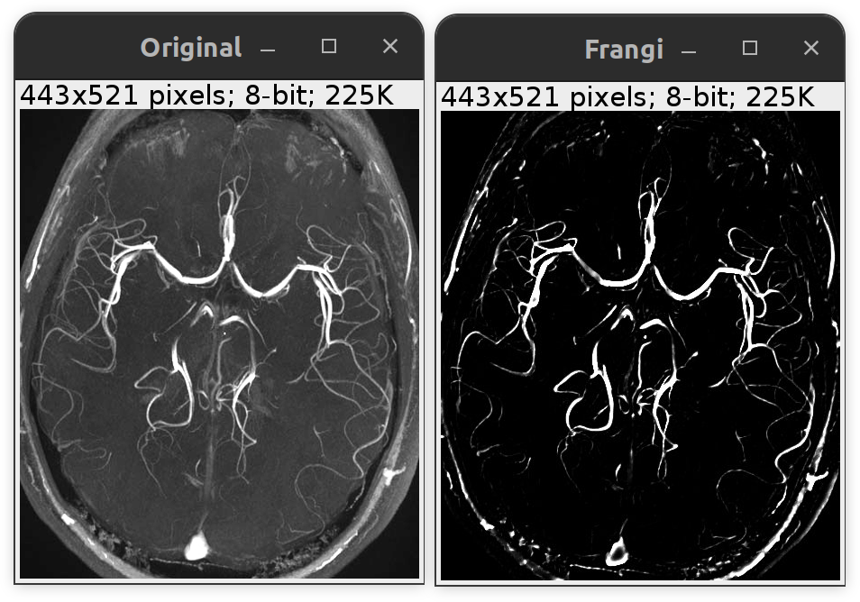 /media/plugins/frangi-before-and-after.png