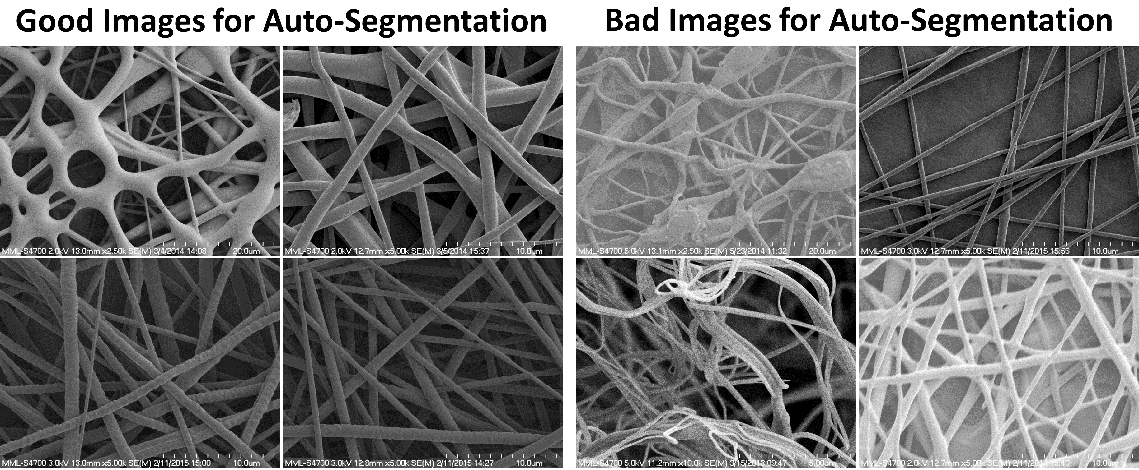 Example images that segment well and that do not segment well with DiameterJ's default segmentation algorithms