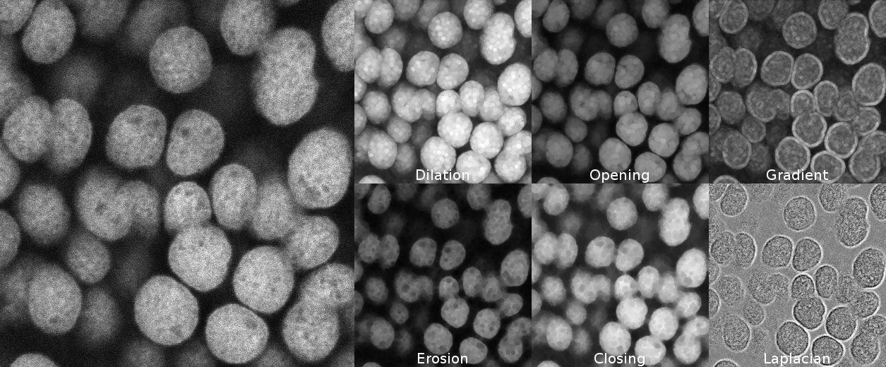 Error with ImageJ Plug In Max Inscribed Circles - Usage & Issues