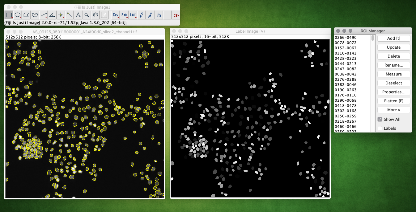 Stardist 3D Training Error with Original Config Values - Usage & Issues -  Image.sc Forum