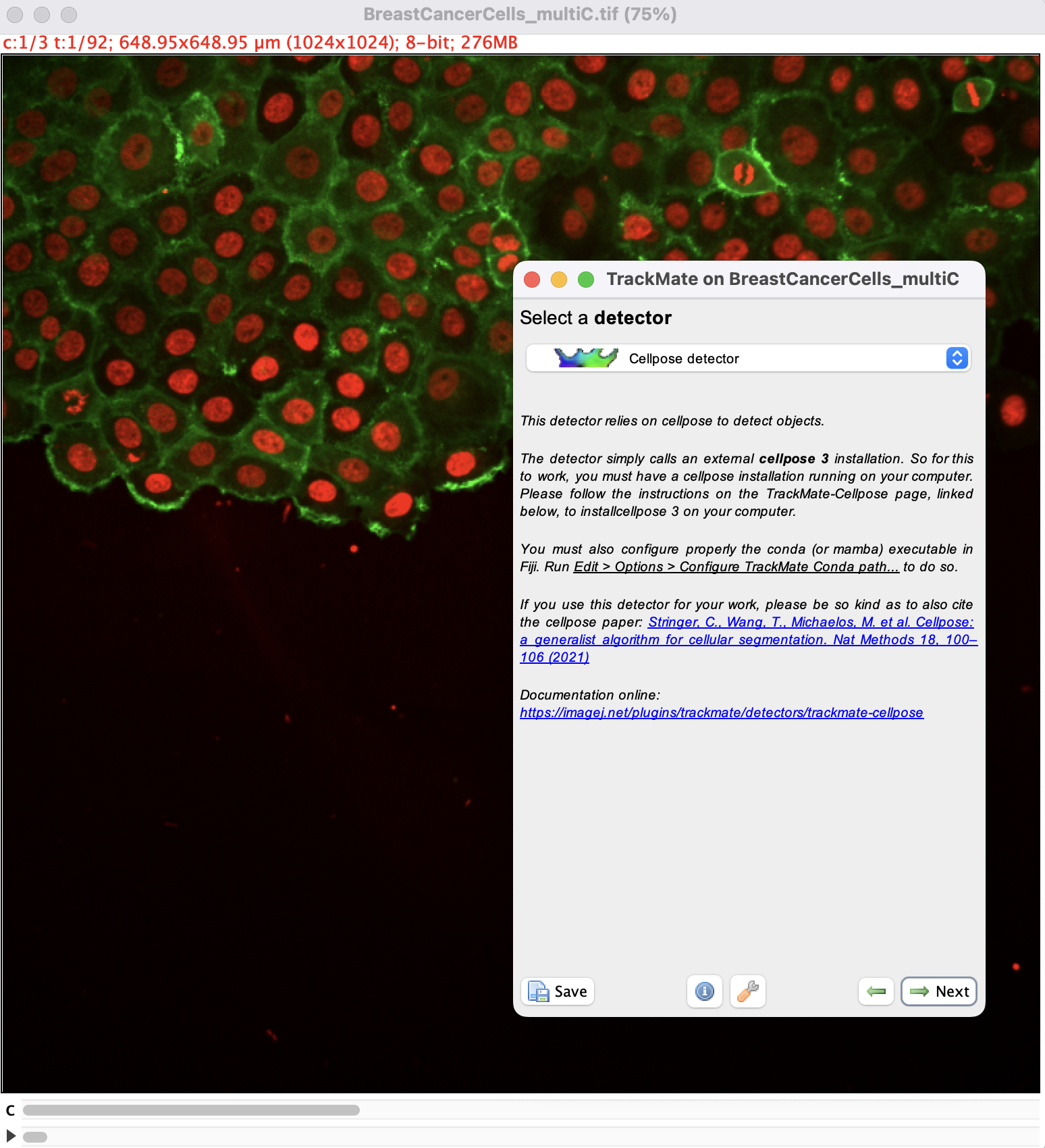 /media/plugins/trackmate/detectors/cellpose/trackmate-cellpose-tutorial-02