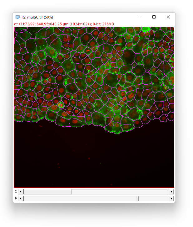 /media/plugins/trackmate/detectors/cellpose/trackmate-cellpose-tutorial-05
