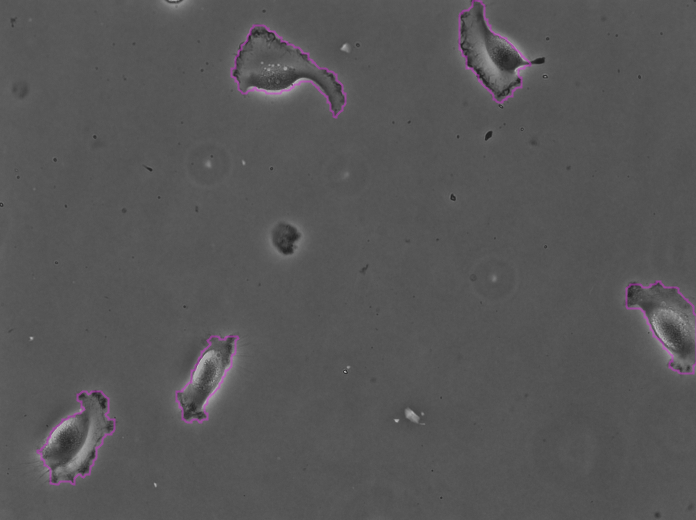 /media/plugins/trackmate/detectors/cellpose/trackmate-cellpose-tutorial-b-03