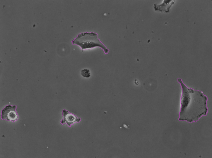 /media/plugins/trackmate/detectors/cellpose/trackmate-cellpose-tutorial-b-04