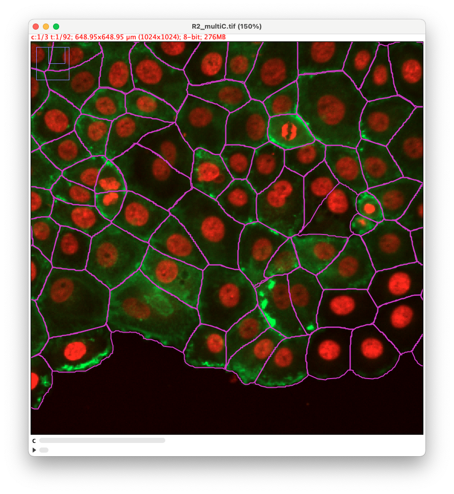 /media/plugins/trackmate/detectors/trackmate-cellpose-sam-allchannels.png