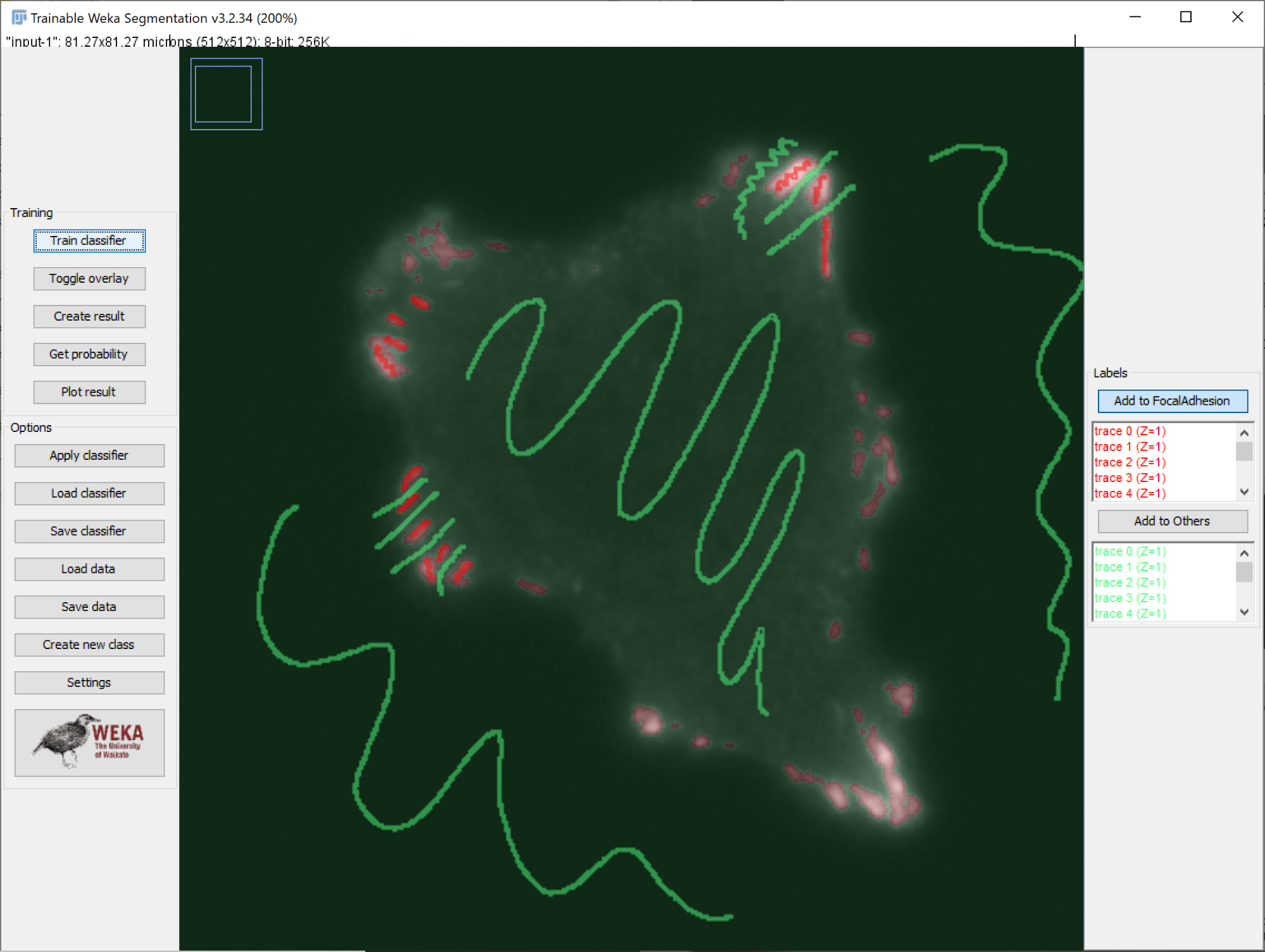 /media/plugins/trackmate/detectors/trackmate-weka-detector-image5.png
